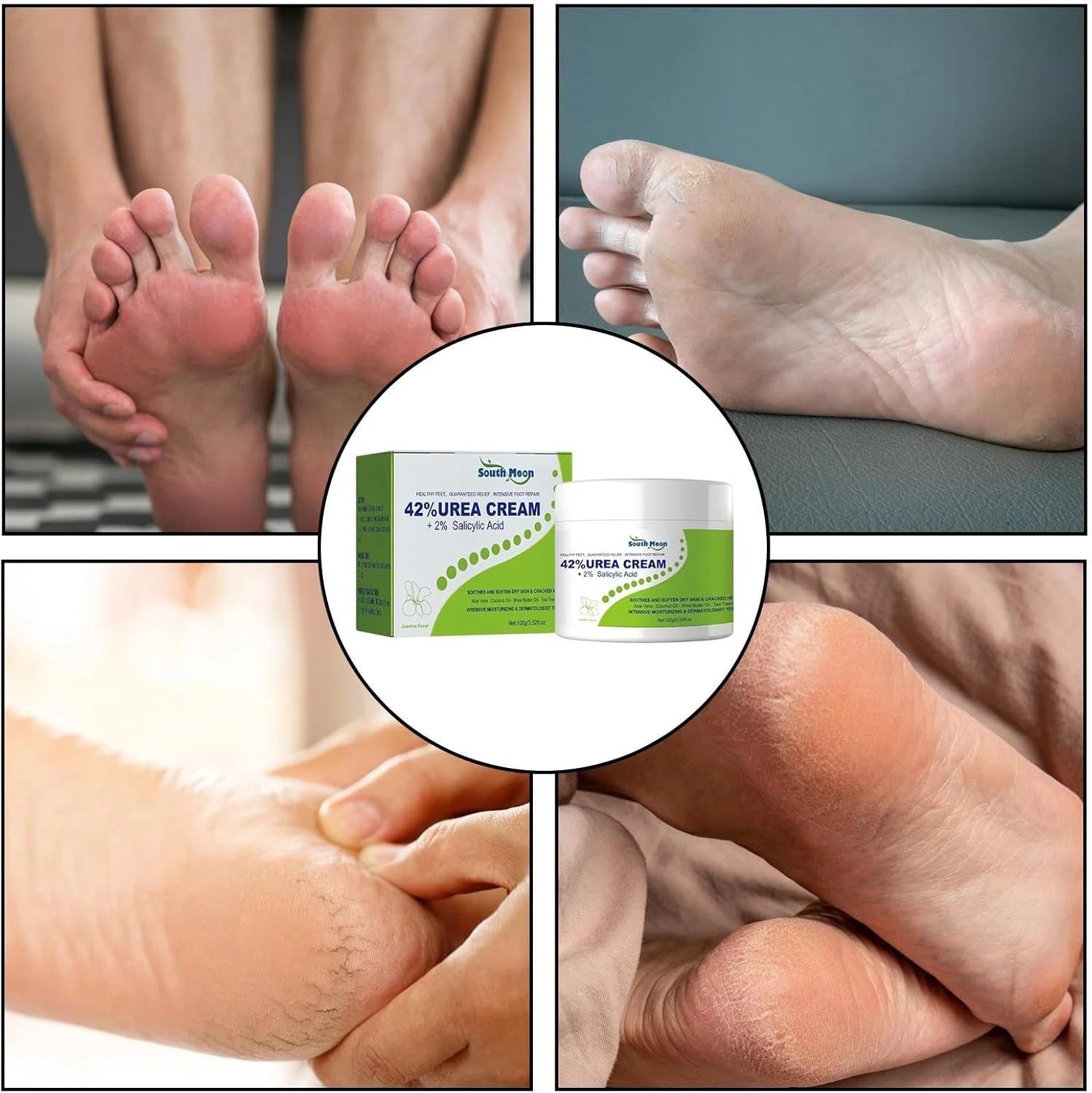 42% Urea Cream