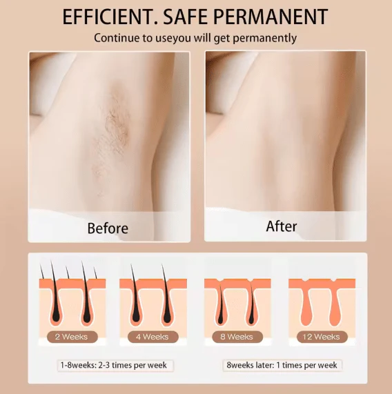 Digital Hair Removal