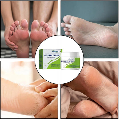 42% Urea Cream