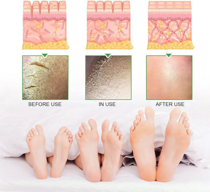 42% Urea Cream