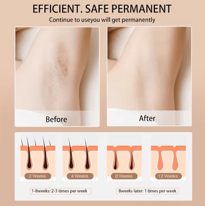 Digital Hair Removal